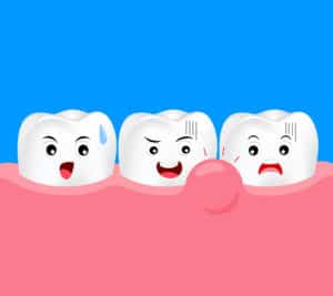 Swelling of Gums - Direct DEnture Care Perth WA