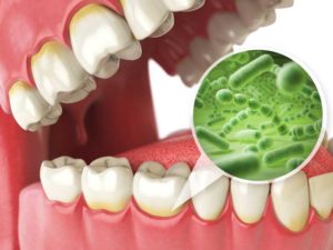 Bacteria on Teeth