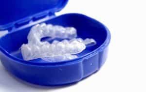 Mouthguard by Direct Denture Care in Perth