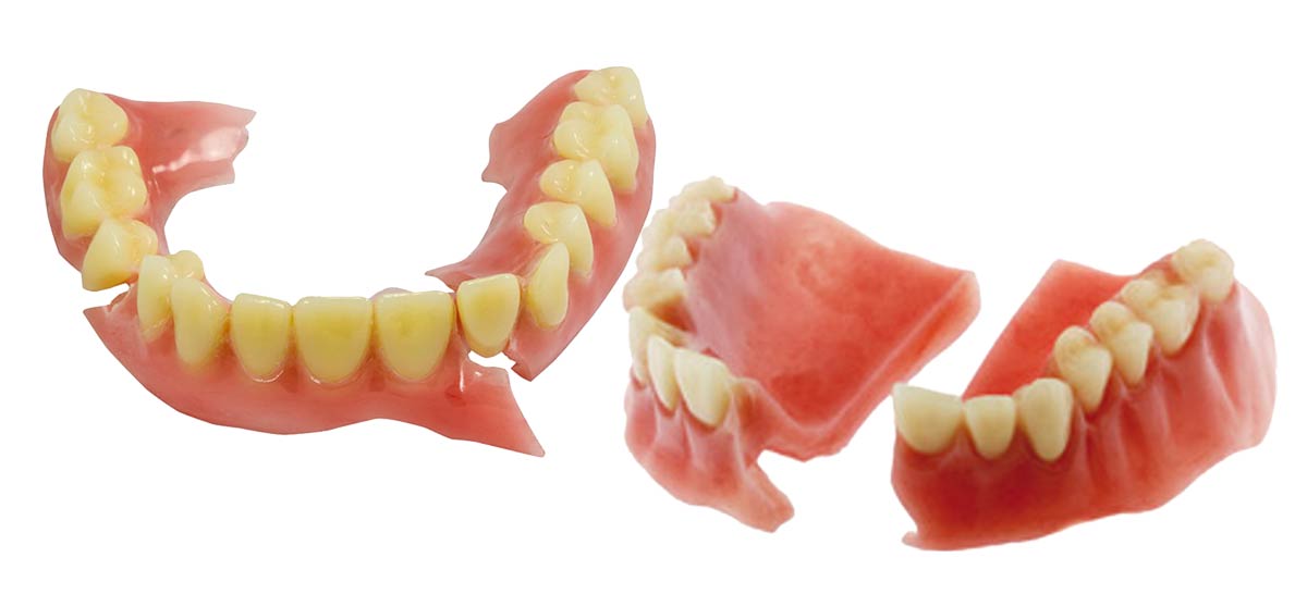 Denture Repairs