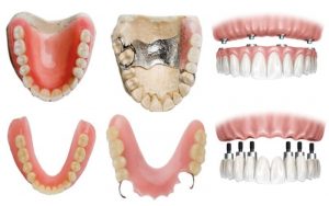 Denture Care Leamington