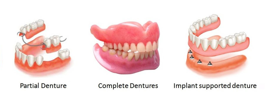 Partial Dentures Leamington