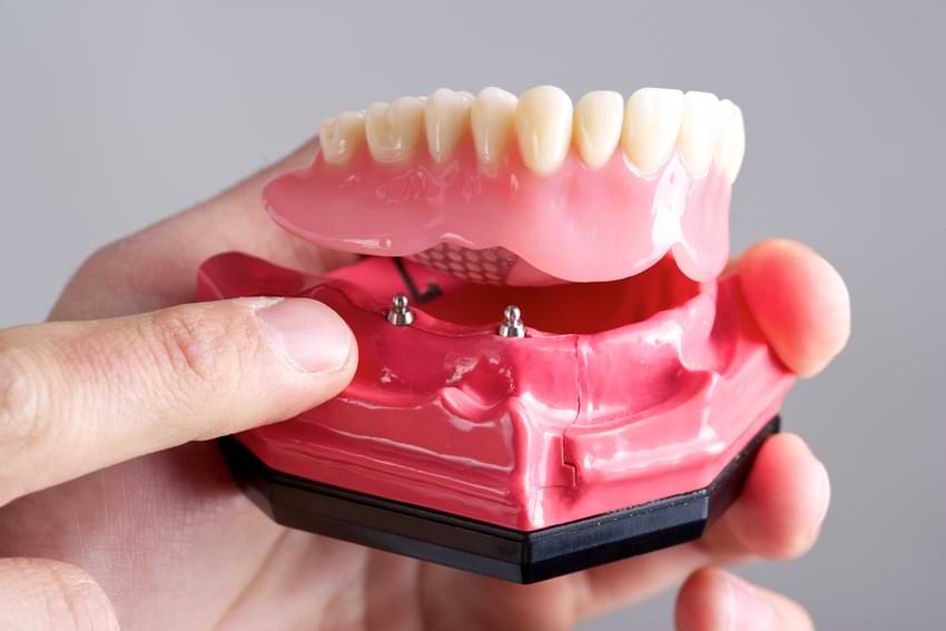 Can Removable Dentures Meet Your Specific Needs & Preferences?